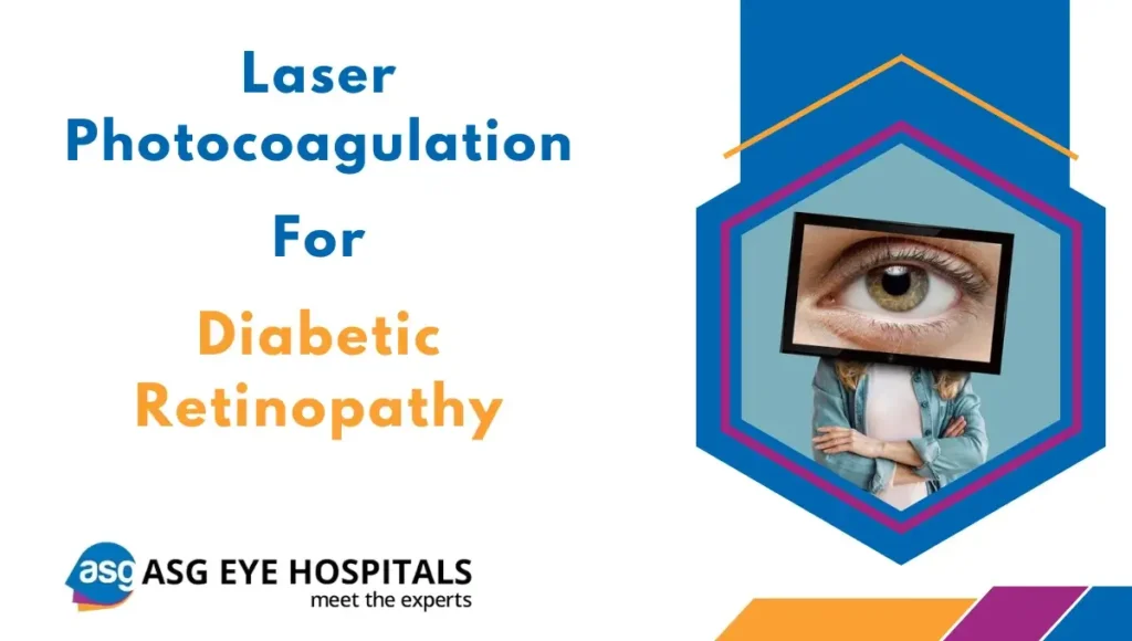 Laser photocoagulation for Diabetic Retinopathy