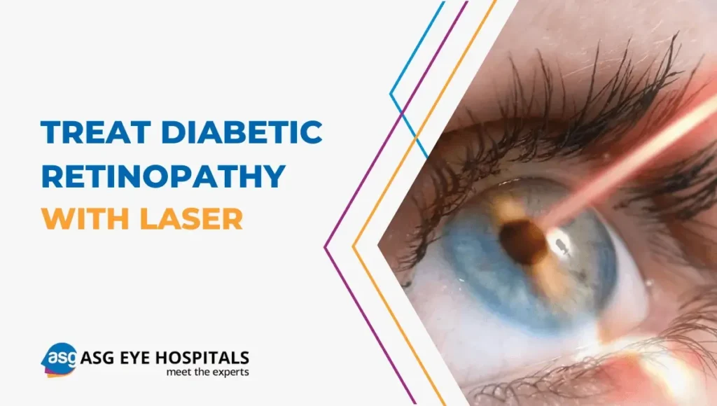 Treat Diabetic Retinopathy with Laser