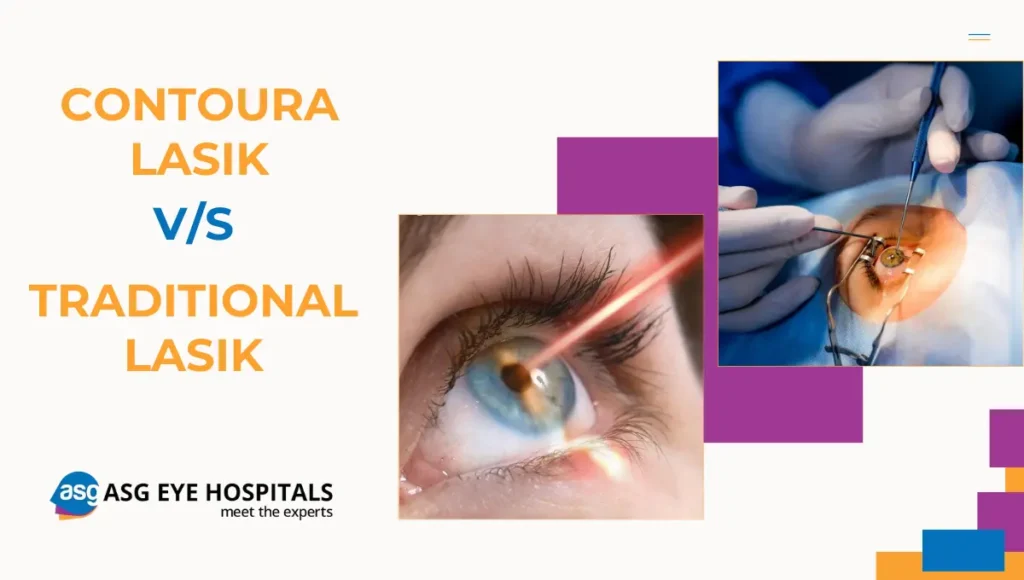 Comparing Contoura Lasik vs. Traditional Lasik Which Is Right for You