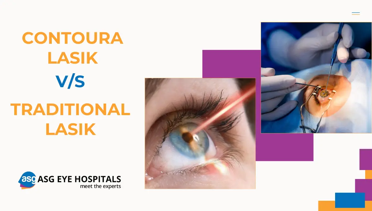 Comparing Contoura Lasik vs. Traditional Lasik Which Is Right for You