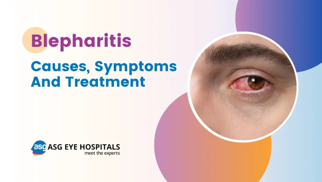Blepharitis - Causes, Symptoms and Treatment