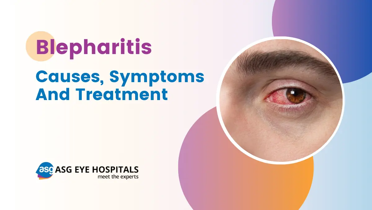 Blepharitis - Causes, Symptoms and Treatment