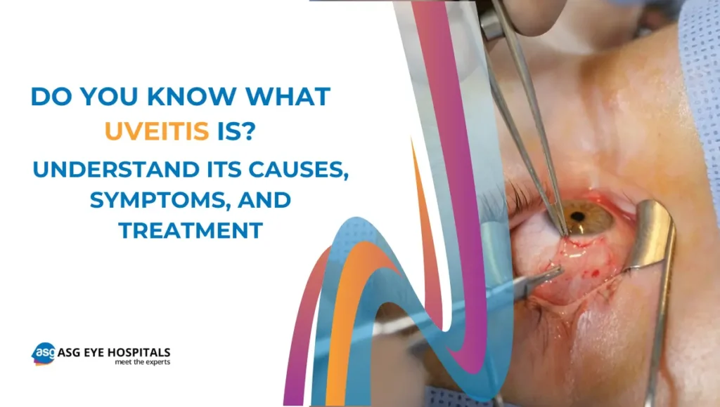 Do You Know What Uveitis Is, Understand its Causes, Symptoms, and Treatment