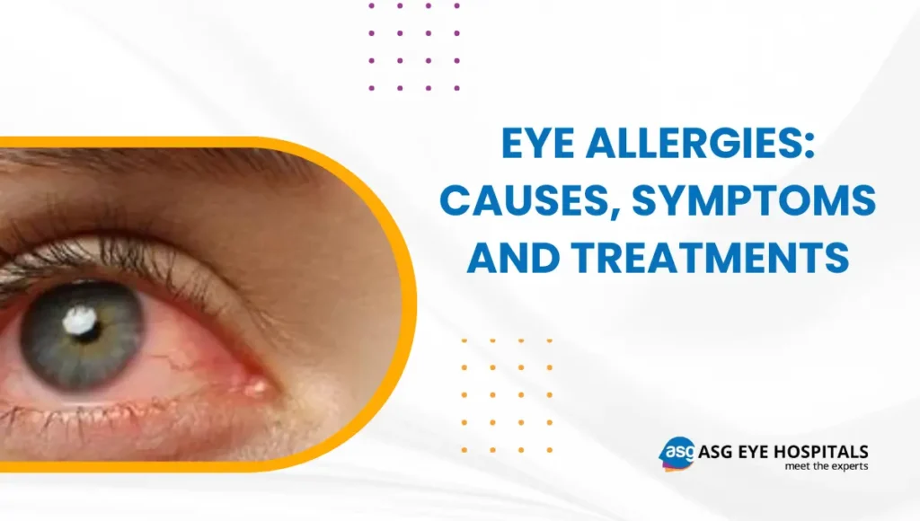 Eye Allergies Causes, Symptoms and Treatments