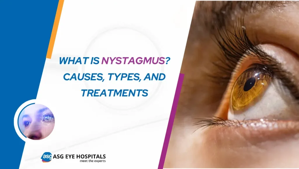 What is Nystagmus