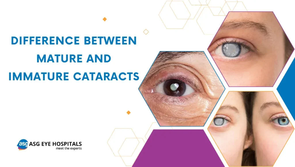 What is the Difference between mature and immature cataracts