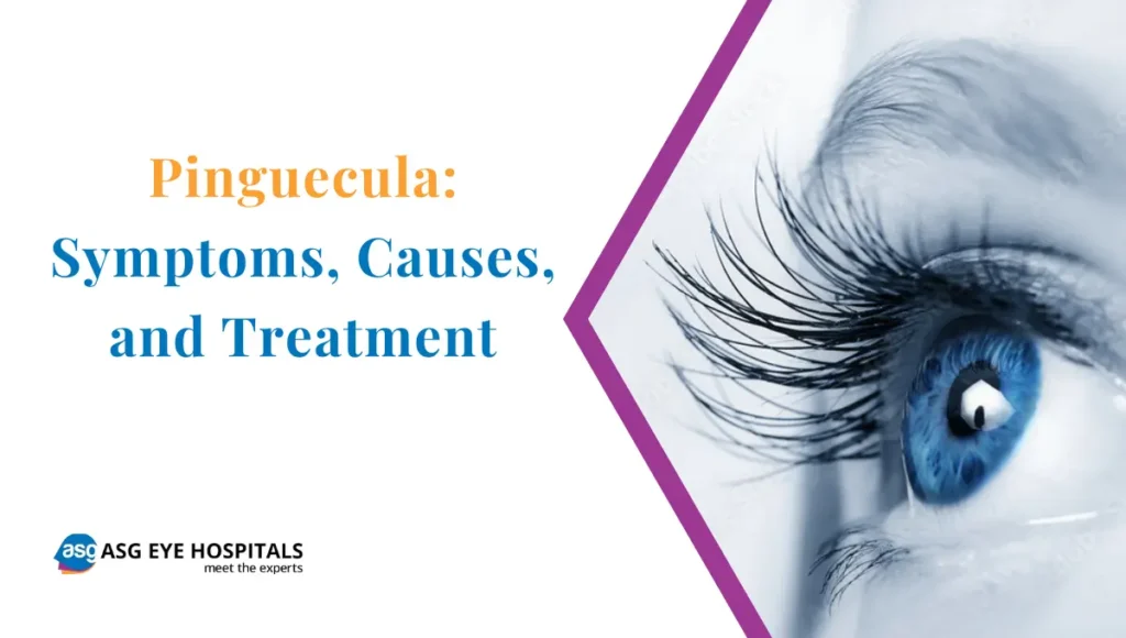 Pinguecula Symptoms, Causes, and Treatment