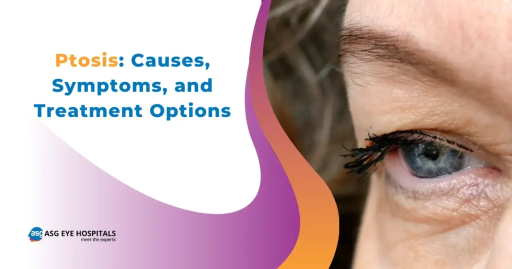 Ptosis Causes, Symptoms, and Treatment Options