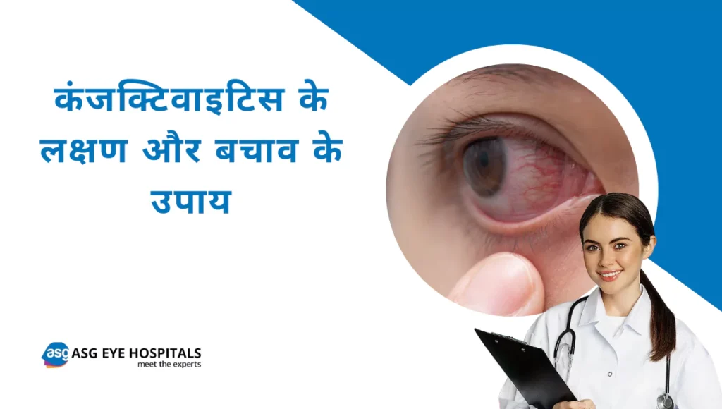 कंजक्टिवाइटिस के लक्षण और बचाव के उपाय