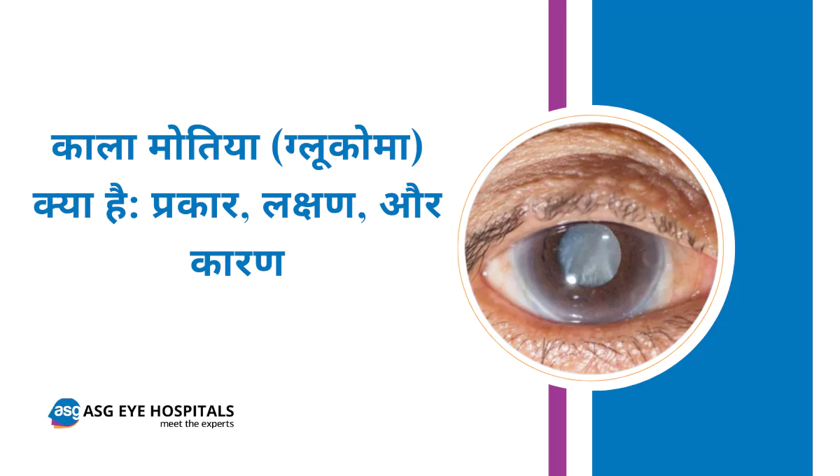काला मोतिया (ग्लूकोमा) क्या है प्रकार, लक्षण, और कारण
