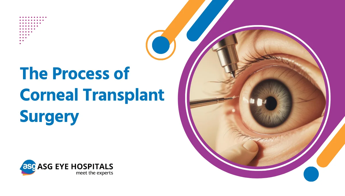 The Process of Corneal Transplant Surgery