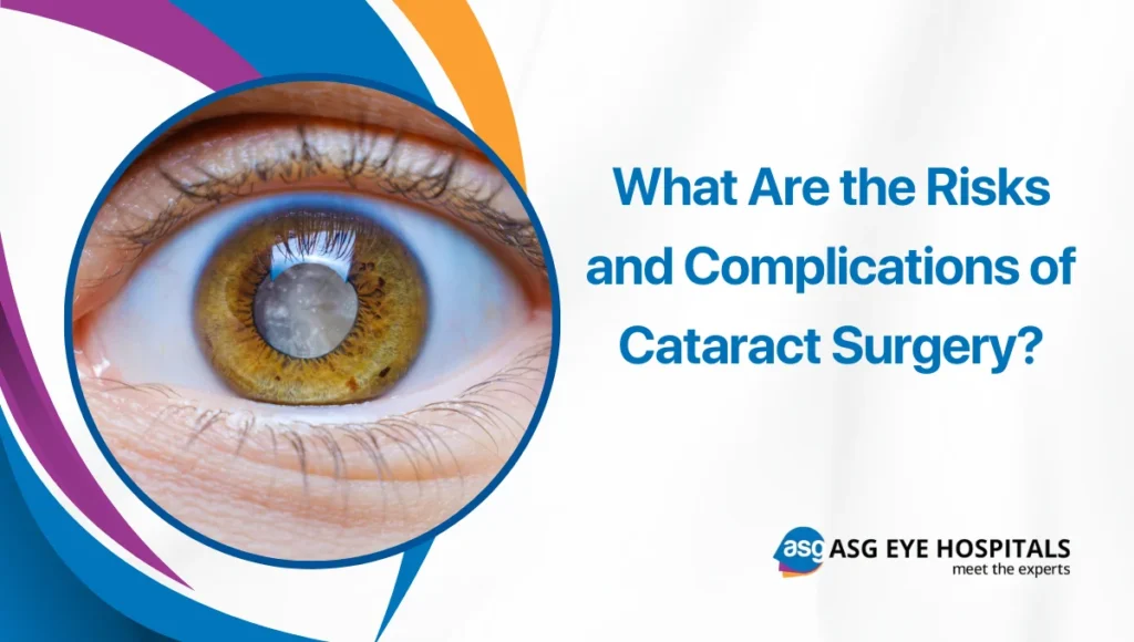 What Are the Risks and Complications of Cataract Surgery