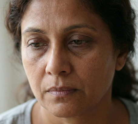 Cosmetic concerns such as under-eye bags or hollow eyelids