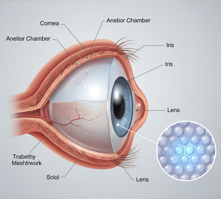 Adequate anterior chamber depth and endothelial cell health (assessed during screening).