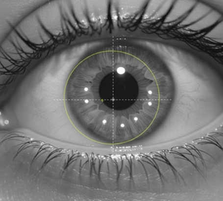 Pupil size checked to minimise potential glare or halos in dim light.