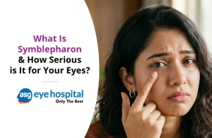 What Is Symblepharon & How Serious Is It for Your Eyes