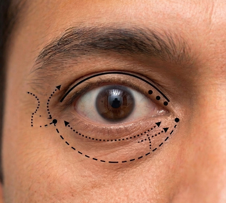 Prominent or bulging eyes