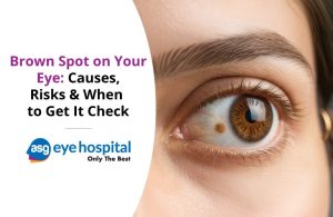 brown spot on eye