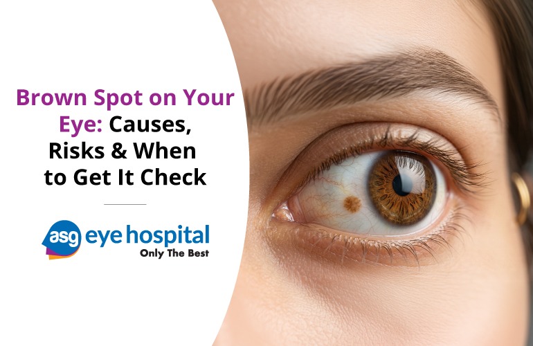 brown spot on eye