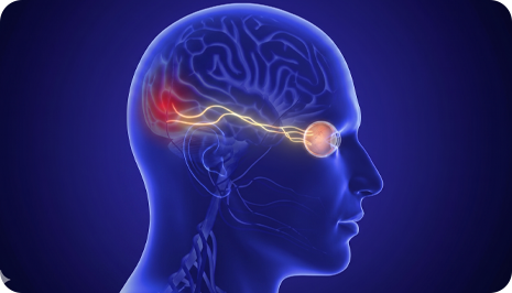 Neuro-Ophthalmology Disorders