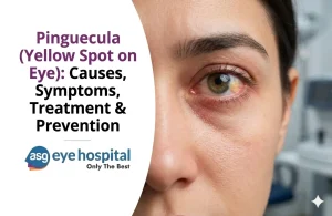 Pinguecula (Yellow Spot on Eye)