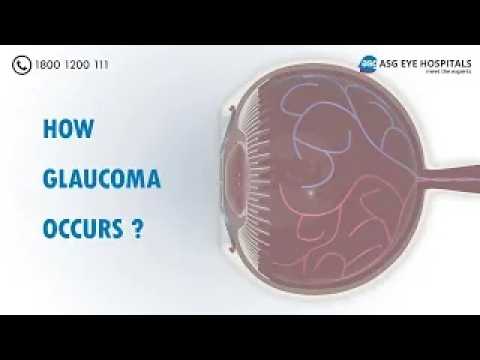काला मोतियाबिंद कैसे होता है | Glaucoma (ग्लूकोमा) Animation Explained