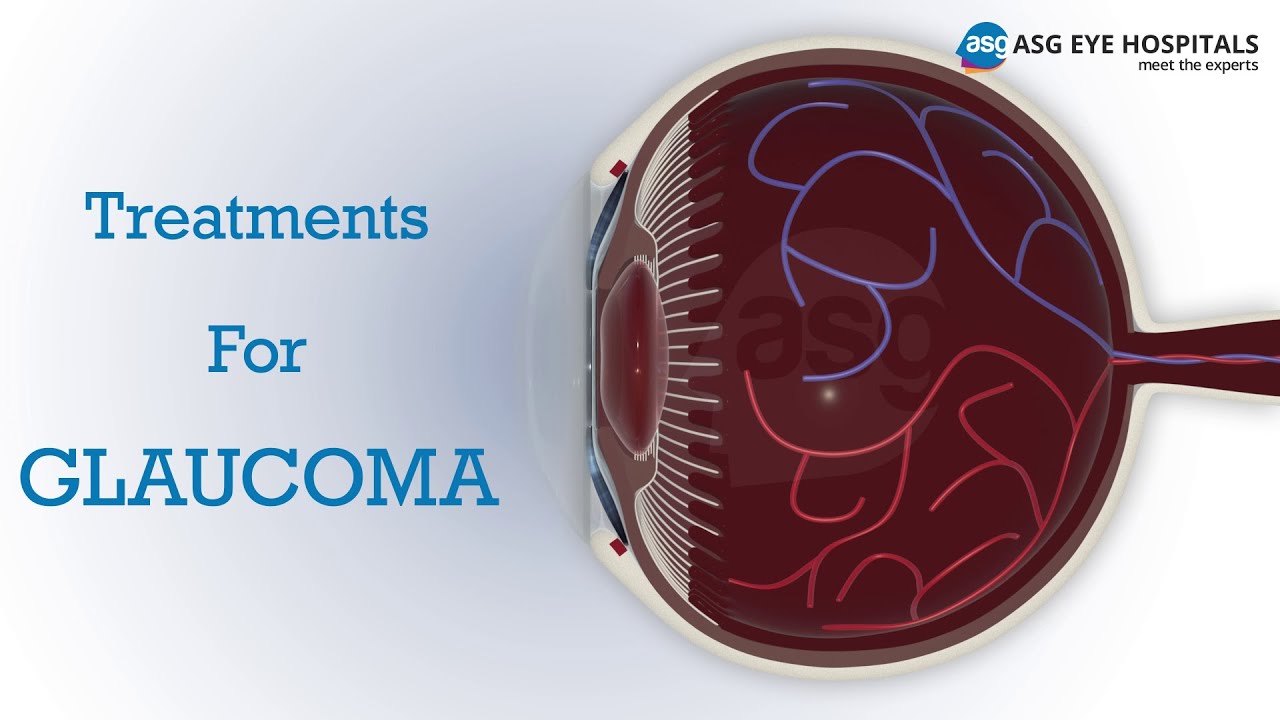 Don’t Let Glaucoma Steal Your Sight – Discover Advanced Glaucoma Treatments at ASG Eye Hospital
