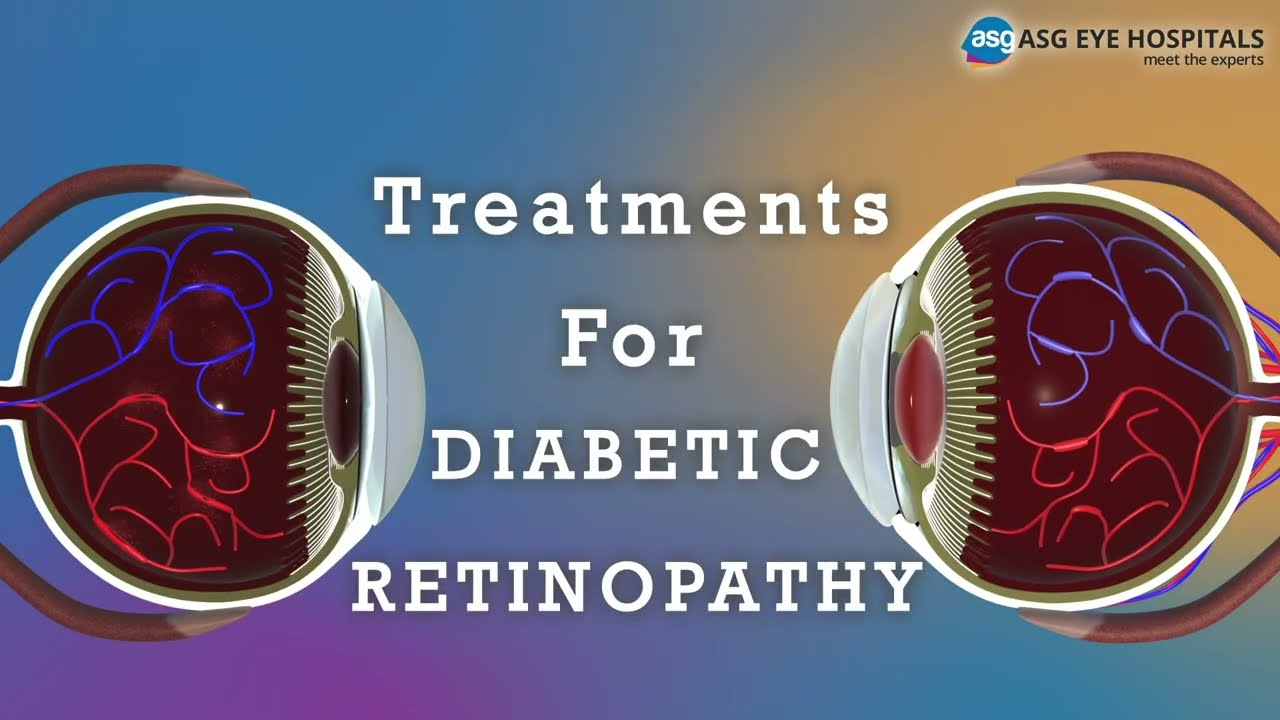 Top Ophthalmologist Reveals BEST Treatment for Diabetic Retinopathy