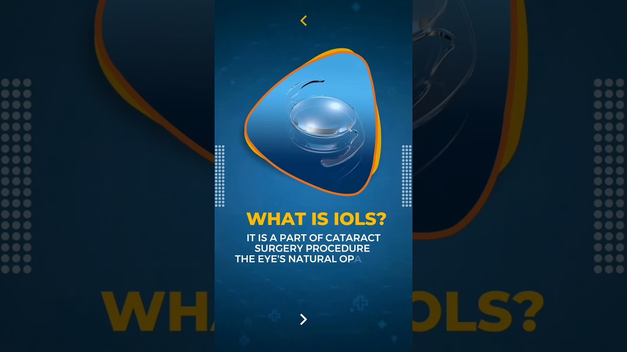 IOL-Intraocular Lens | Cataract Surgery | ASG Eye Hospital