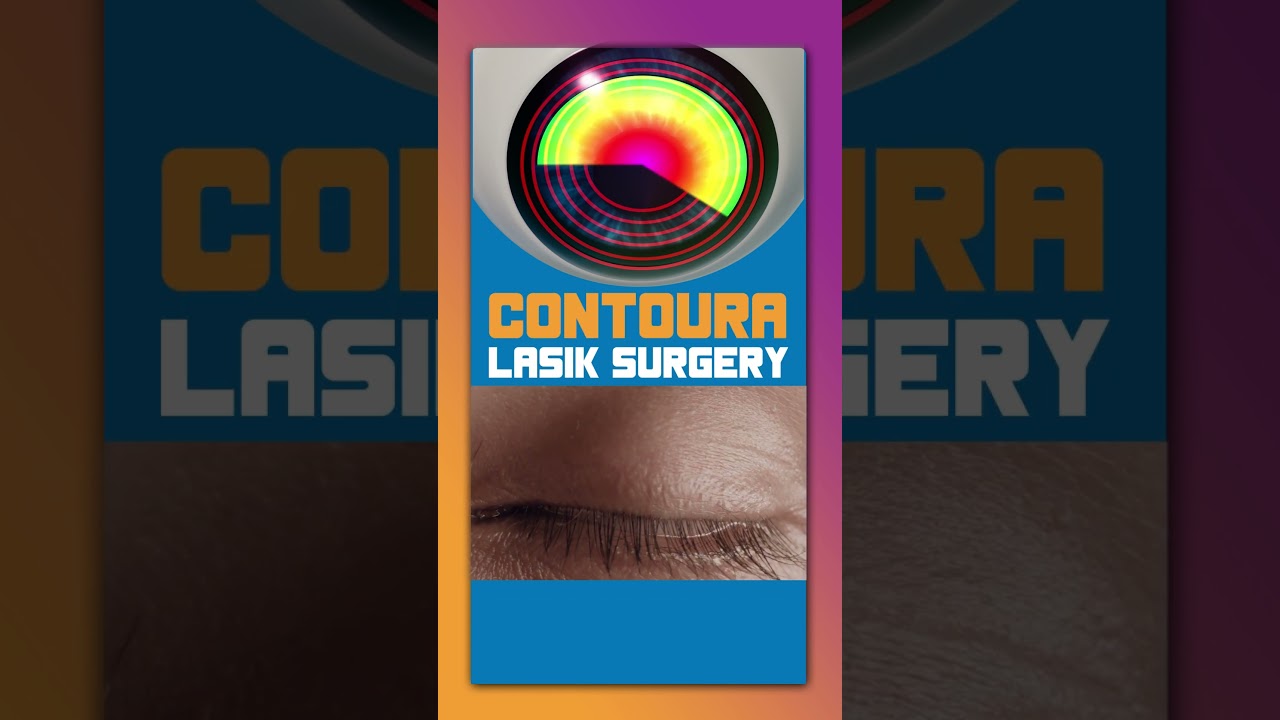 Unveiling Clarity: The Contoura LASIK Experience at ASG Eye Hospital | Best Eye Care in India
