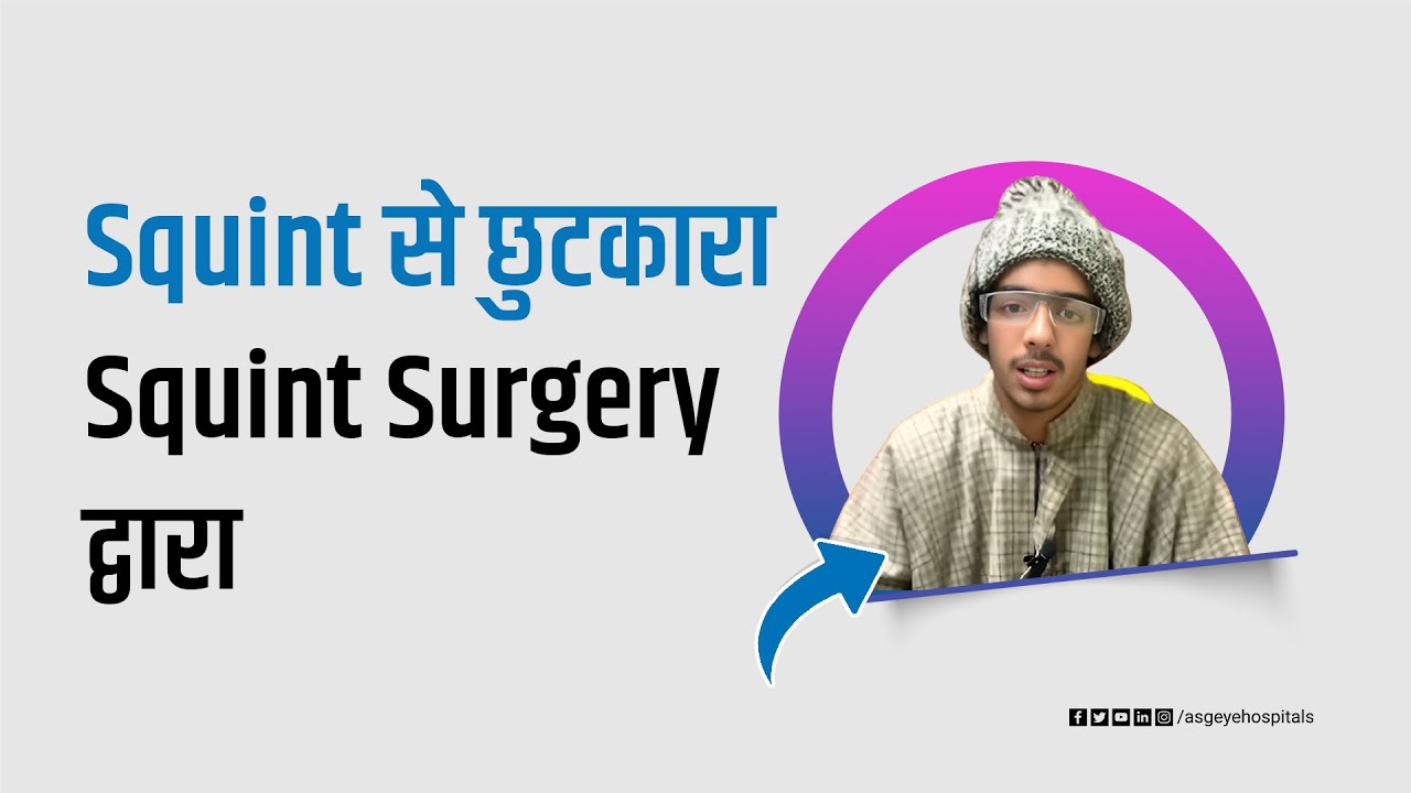 Finally Found Relief From Squint | Patient Testimonial | ASG Eye Hospitals